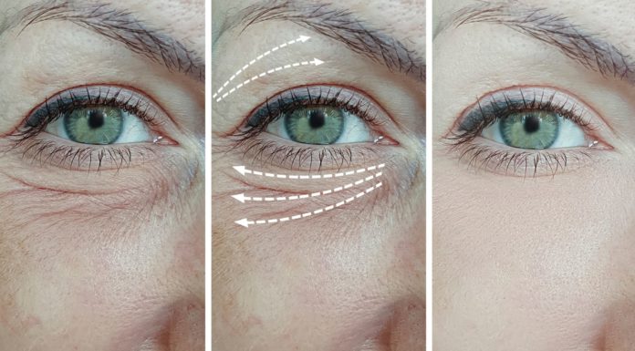 Как убрать морщины и темные круги под глазами?