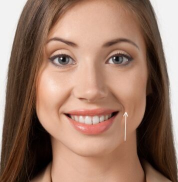 Поднимаем уголки губ «Упражнение Улыбка»