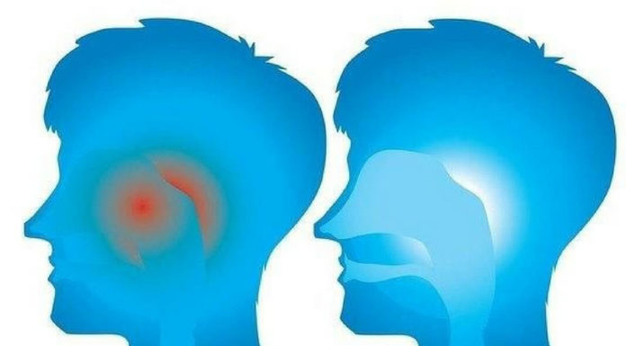 Как избавиться от аллергического насморка народными способами! Как избавиться от аллергического насморка народными способами