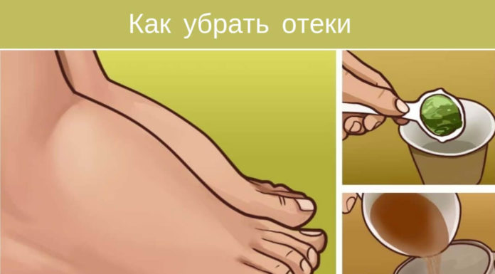 Как снять отечность эффективно и просто?
