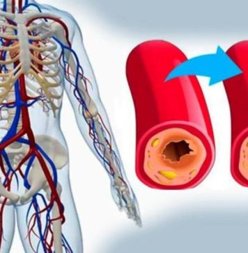 Народные рецепты для укрепления сосудов