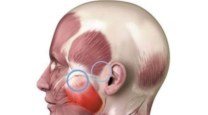 Жевательные мышцы — как избавиться от гипертонуса, спазма