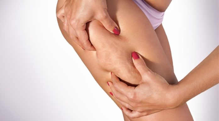 Как избавиться от целлюлита? Обертывания, маски и травяные настои!