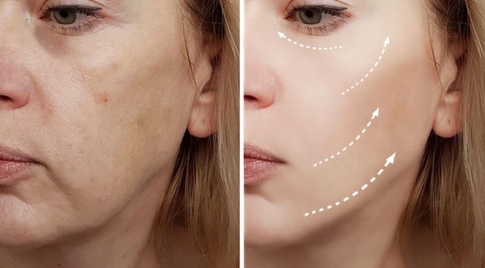 Видео Секретная техника от провалов щек, для подтяжки щек